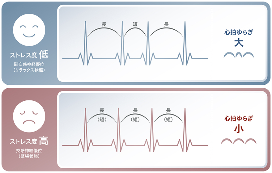 図:心拍ゆらぎとストレス度合いの関係性(ストレス度 低とストレス度 高の違い)