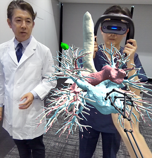 MR Anatomyの視点イメージ(見え方)高精細な3D画像の観察が可能